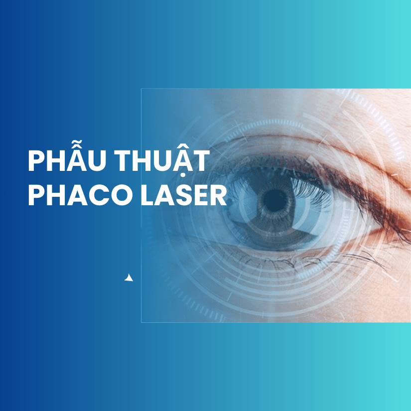 Phẫu thuật PHACO KHÔNG DAO