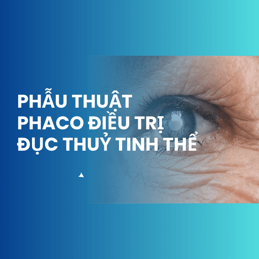Phẫu thuật PHACO điều trị đục thủy tinh thể