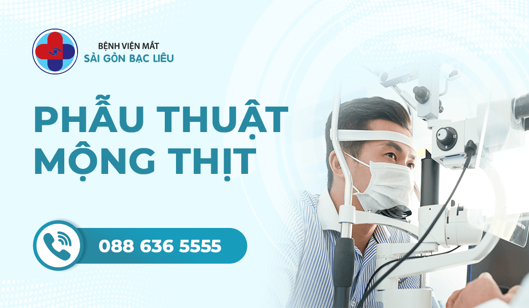 Phẫu thuật SMILE (ReLEx SMILE)